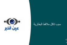 سبب تاكل ملاقط البطارية 220x150 - تعرف على أسباب تكون الأملاح على أقطاب البطارية وكيفية تنظيفها